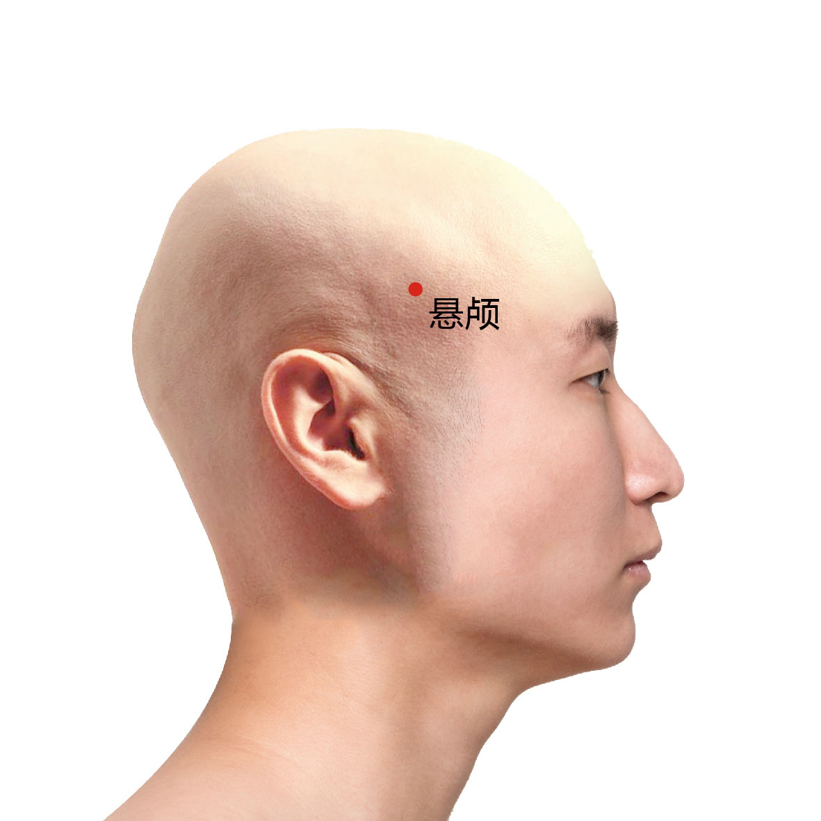 悬颅