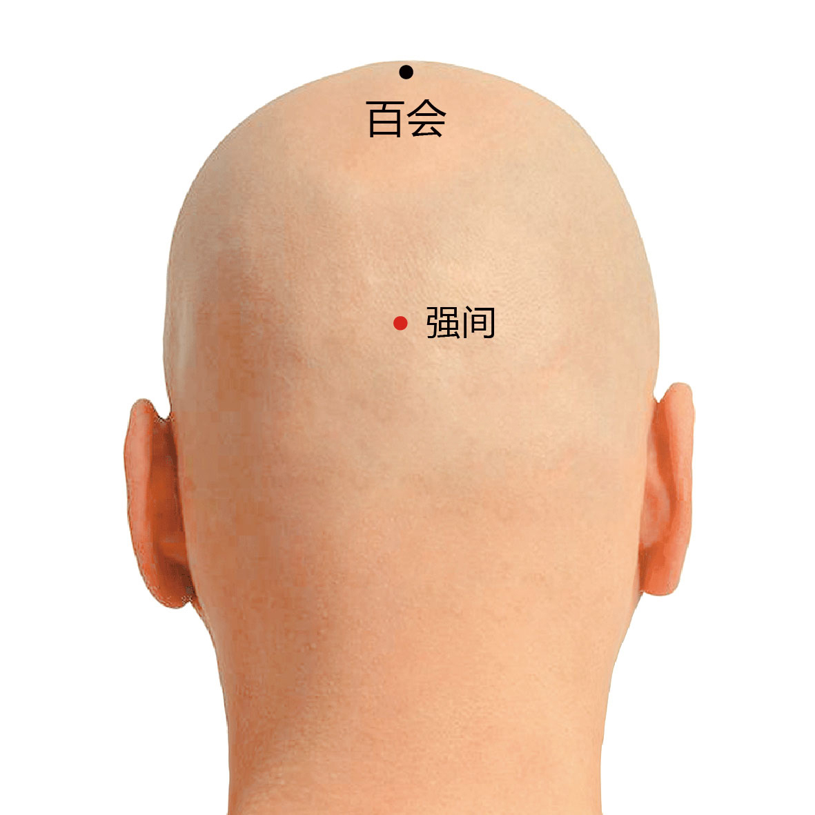 后顶