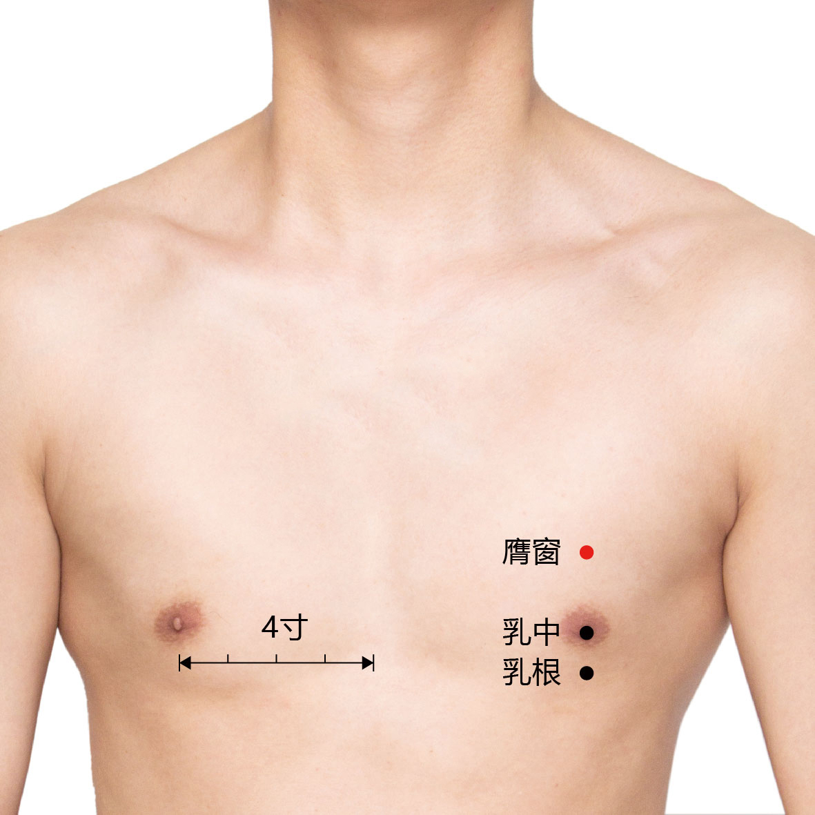 膺窗