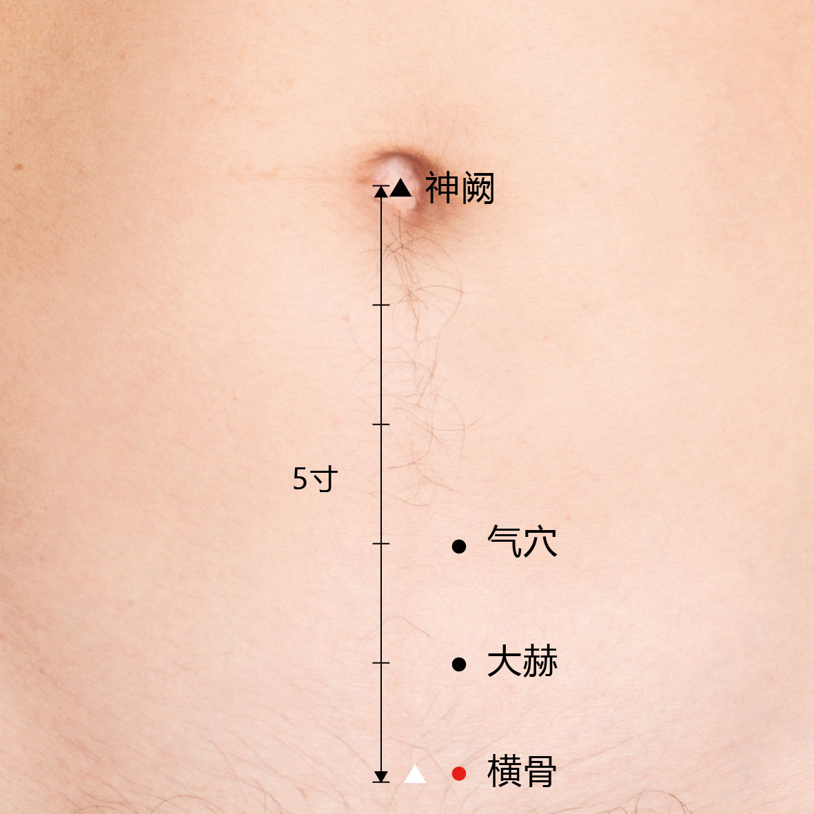 气穴