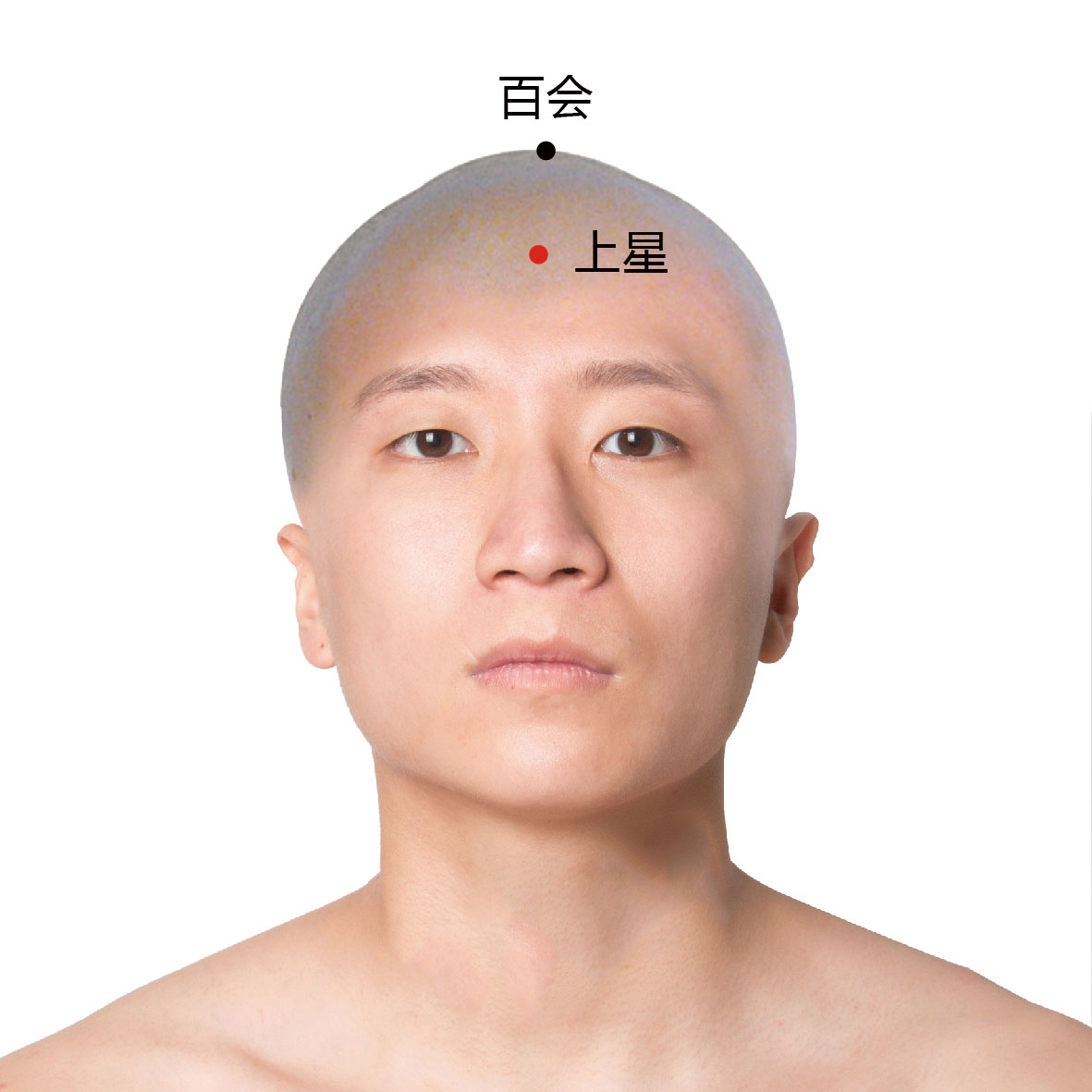 神庭