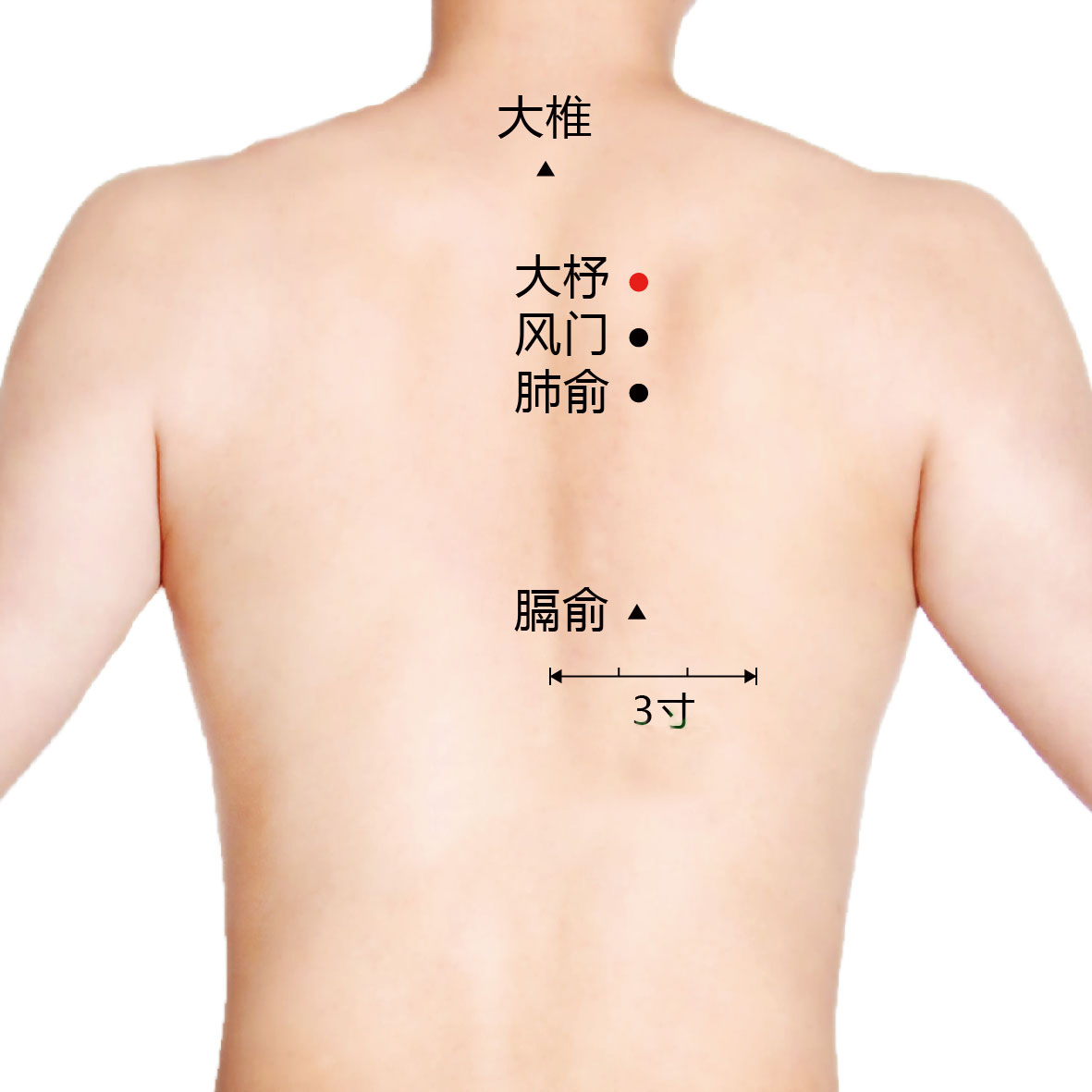 风门