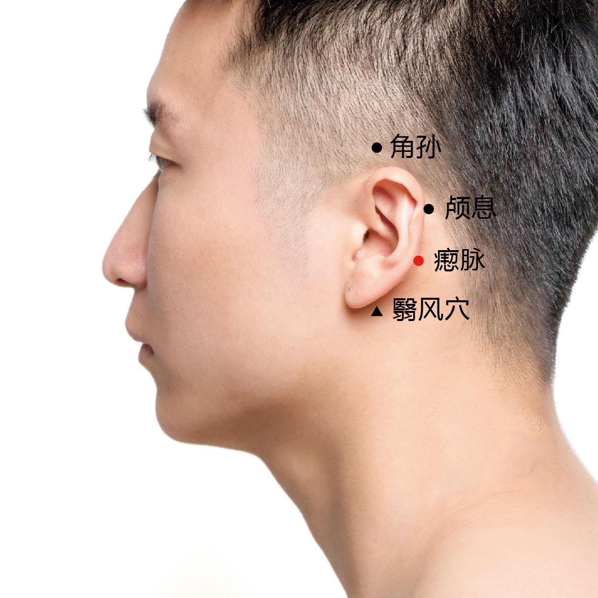 瘈脉