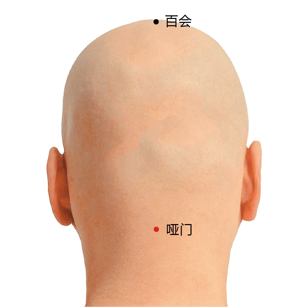 脑户