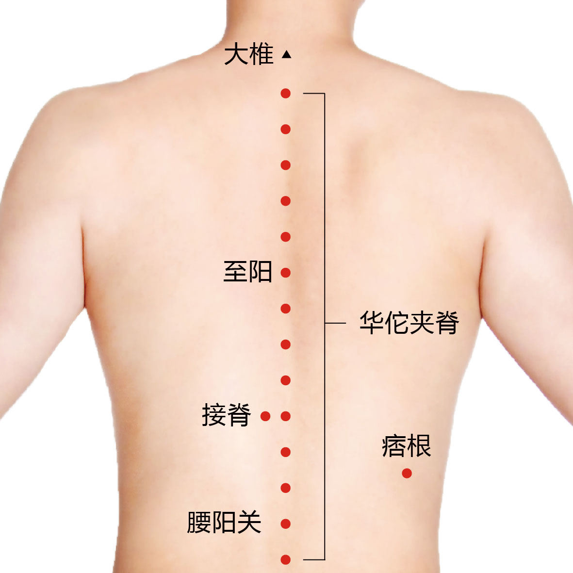 痞根