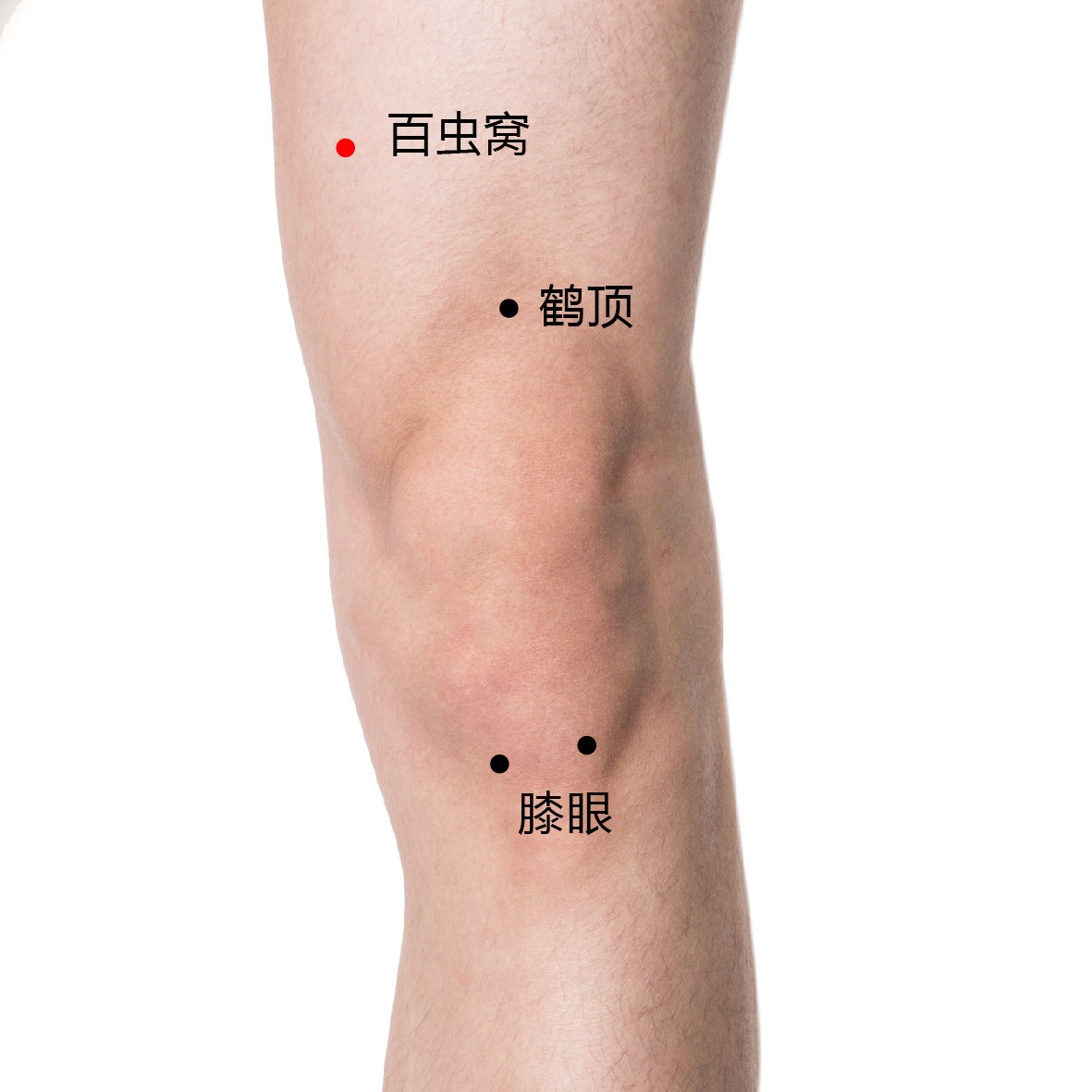 百虫窝