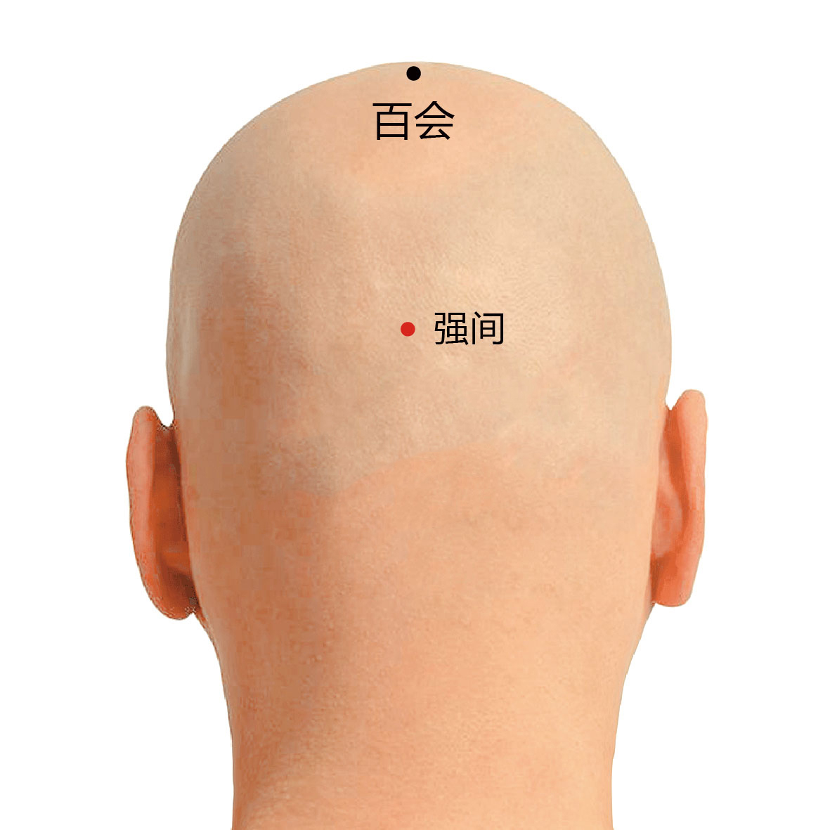 百会