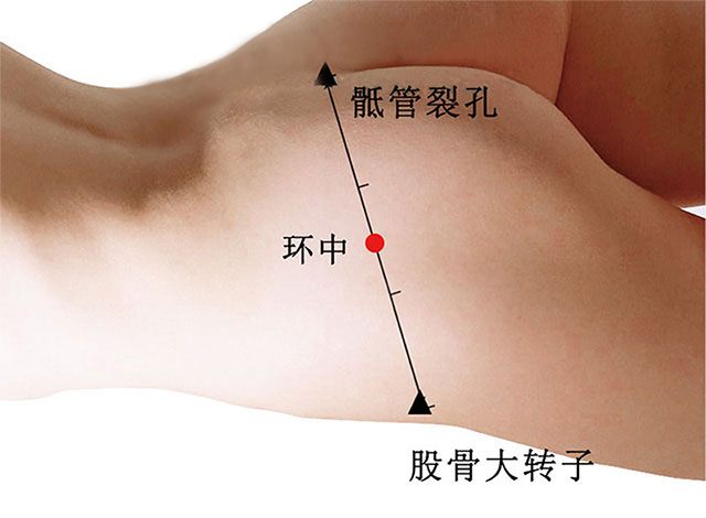 环中