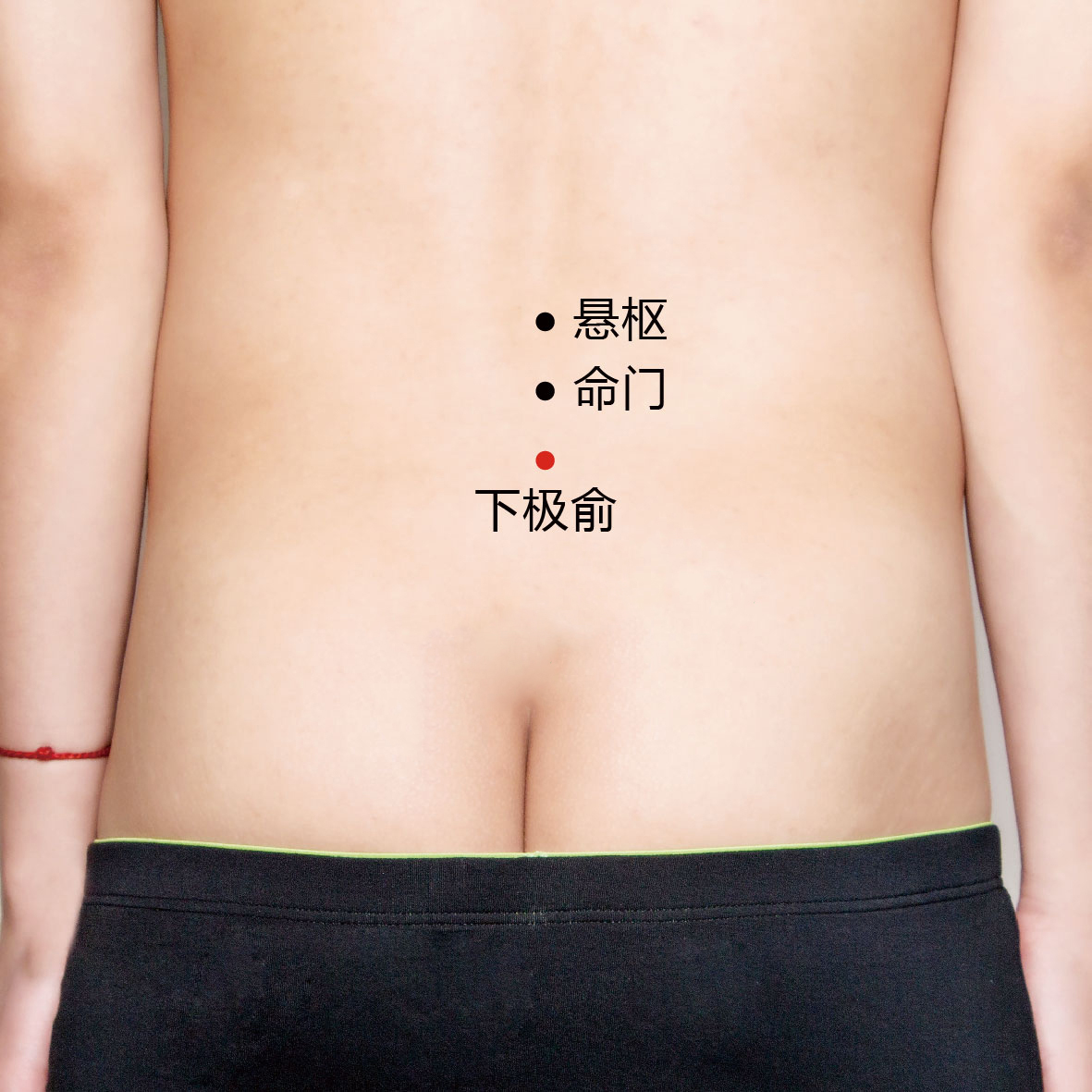 命门