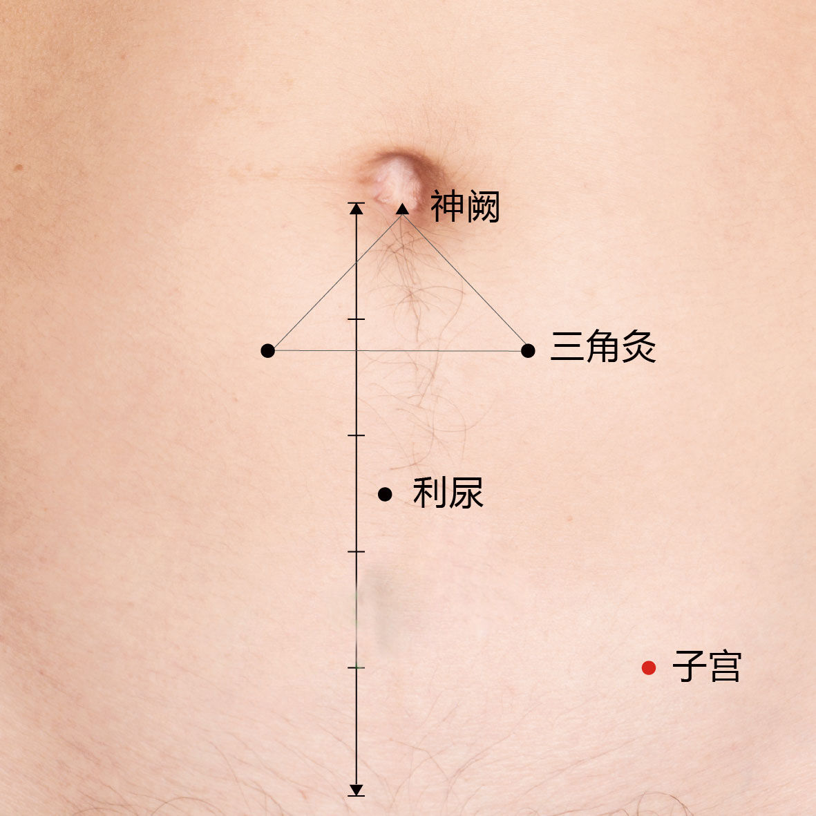三角灸